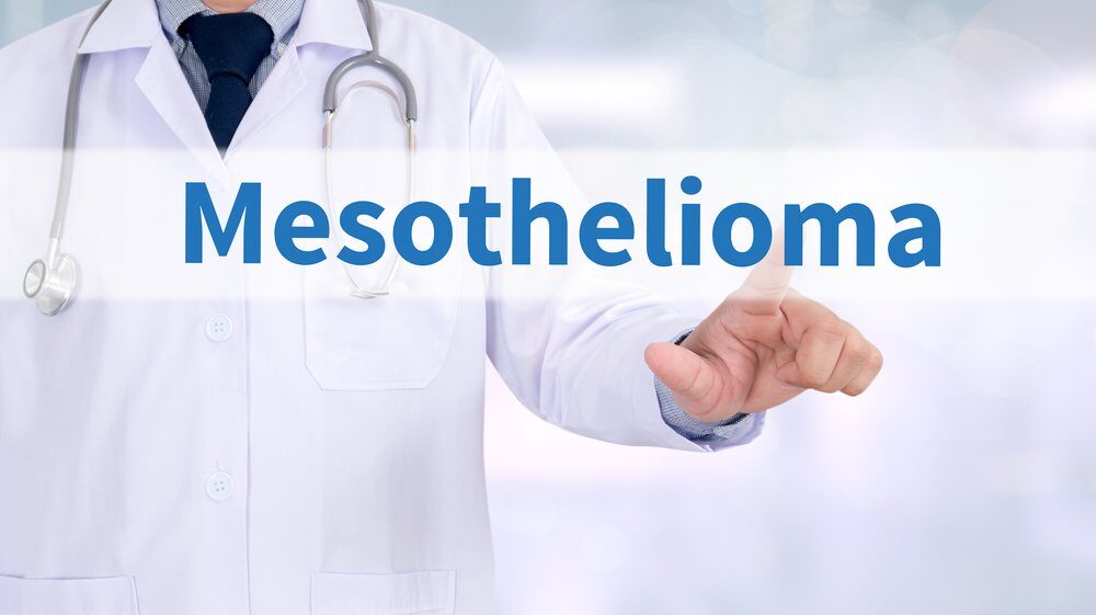 Chicago Mesothelioma Lawyers: Seeking Justice for Asbestos Victims, How to Choose the Right Chicago Mesothelioma Lawyer